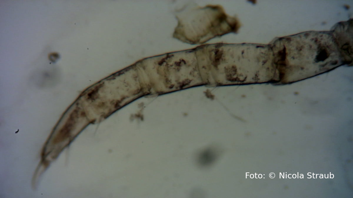 Insekten-Fuß unter dem Mikroskop (Igel Kotuntersuchung)