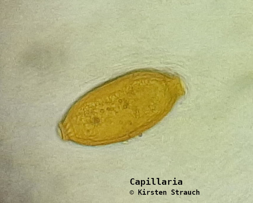 Capillaria (Haarwurm) Ei (c) Kirsten Strauch