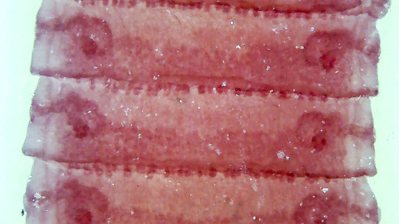Hymenolepis mature