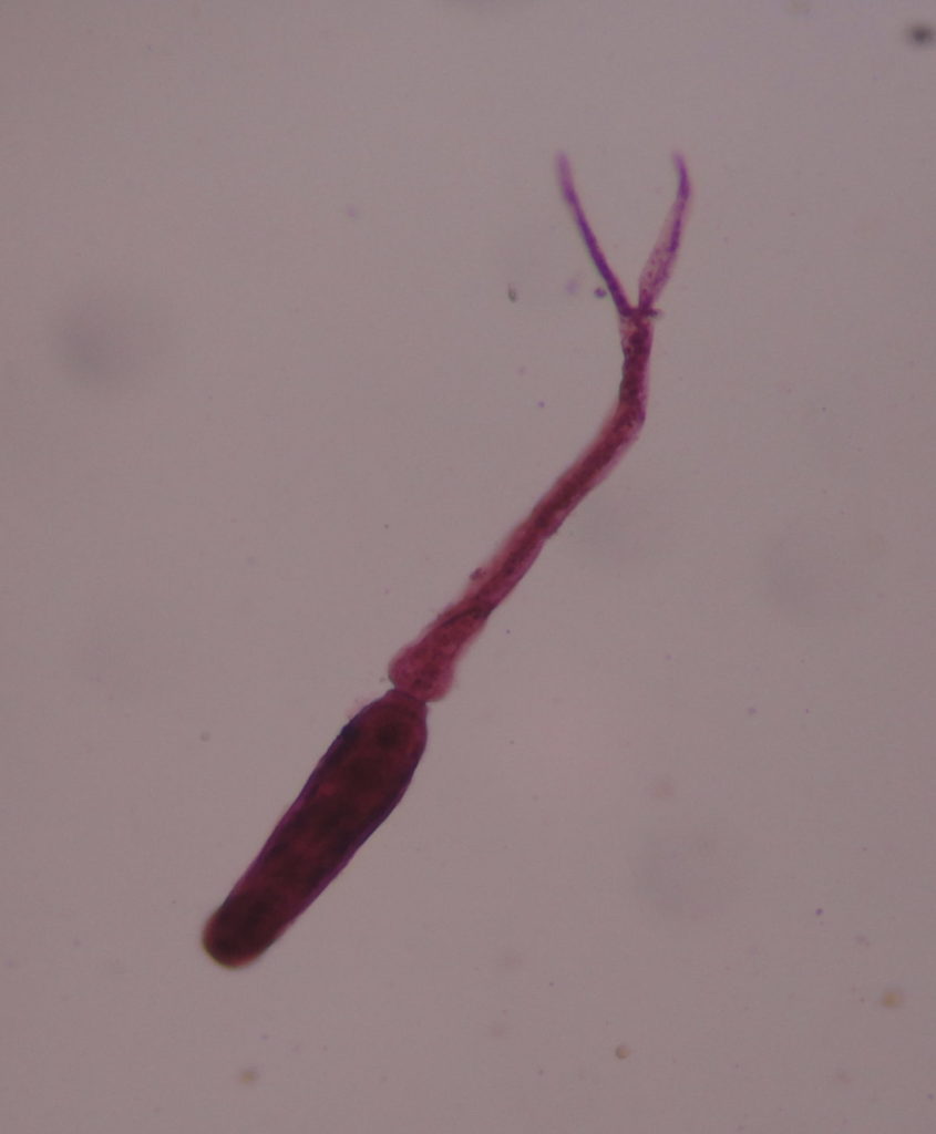Zerkarie von Schistosoma