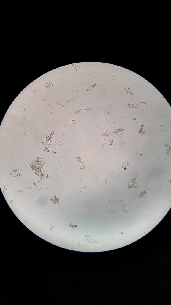 Trichomonaden unterm Mikroskop